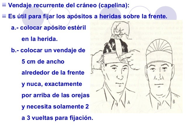 vendajes