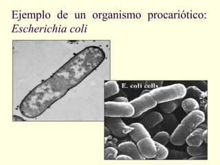 Ejemplo de un organismo procariótico:
Escherichia coli
 