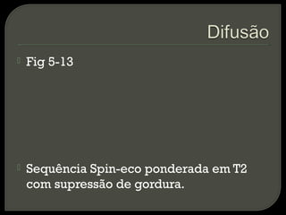  Fig 5-13
 Sequência Spin-eco ponderada em T2
com supressão de gordura.
 