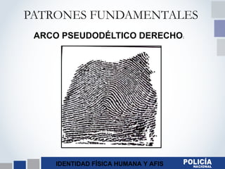 IDENTIDAD FÍSICA HUMANA Y AFIS
PATRONES FUNDAMENTALES
ARCO PSEUDODÉLTICO DERECHO:
 
