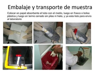 Embalaje y transporte de muestra Colocar en papel absorbente el tubo con el medio, luego en frasco o bolsa plástica y luego en termo cerrado sin pilas ni hielo, y ya esta listo para envío al laboratorio  