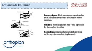 Lesiones de Columna
Lumbago Agudo: El núcleo se desplaza y se introduce
en las fisuras del anillo fibroso excitando los nervios
sensitivos.
Ciática: El núcleo se desplaza más, y llega a presionar
las fibras del nervio ciático.
Hernia Discal: se presenta ruptura de la envoltura
del disco presionando el nervio y la médula.
 