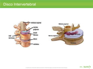 Disco Intervertebral
 