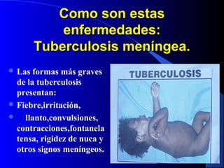 Como son estasComo son estas
enfermedades:enfermedades:
Tuberculosis meníngea.Tuberculosis meníngea.
 Las formas más graves
de la tuberculosis
presentan:
 Fiebre,irritación,
 llanto,convulsiones,
contracciones,fontanela
tensa, rigidez de nuca y
otros signos meníngeos.
 