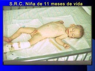 S.R.C. Niña de 11 meses de vida
 