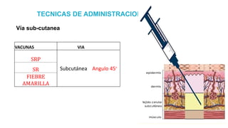 Vía sub-cutanea
TECNICAS DE ADMINISTRACION
VACUNAS VIA
SRP
Subcutánea Angulo 45°
SR
FIEBRE
AMARILLA
 