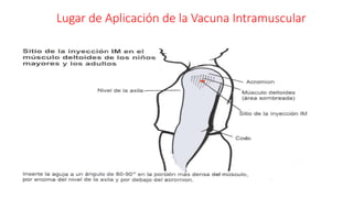 Lugar de Aplicación de la Vacuna Intramuscular
 
