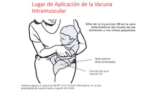 Lugar de Aplicación de la Vacuna
Intramuscular
 