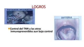 LOGROS
Control del TNN y las otras
inmunoprevenibles aun bajo control
 
