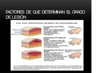 FACTORES DE QUE DETERMINAN EL GRADO
DE LESIÓN
 