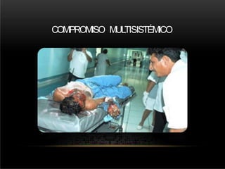 COMPROMISO MULTISISTÉMICO
 