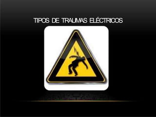 TIPOS DE TRAUMAS ELÉCTRICOS
 