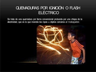 QUEMADURAS POR IGNICIÓN O FLASH
ELÉCTRICO
Se trata de una quemadura por llama convencional producida por una chispa de la
electricidad, que es la que incendia las ropas u objetos cercanos al trabajador.
 