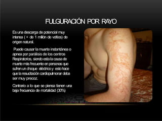 FULGURACIÓN POR RA
YO
Esuna descarga de potencial muy
intensa (+ de 1 millón de voltios) de
origen natural.
Puede causar la muerte instantánea o
apnea por parálisis de los centros
Respiratorios, siendoestalacausade
muertemásfrecuenteenpersonasque
sufrenunchoque eléctricoy estohace
quelaresucitacióncardiopulmonar deba
ser muy precoz.
Contrario a lo que se piensa tienen una
baja frecuencia de mortalidad (30%)
 