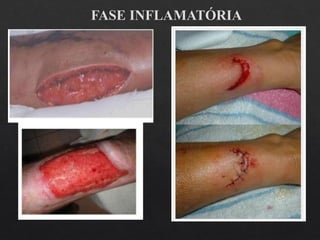 FASE INFLAMATÓRIA
 