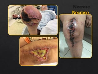 Necrose
 
