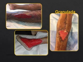 Granulada
APRESENTAÇÃO INSTITUCIONAL
 