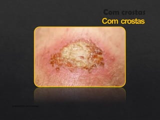 Com crostas
APRESENTAÇÃO INSTITUCIONAL
 