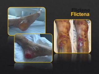 Flictena
APRESENTAÇÃO INSTITUCIONAL
 