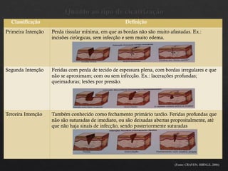 Quanto ao tipo de cicatrização
Classificação Definição
Primeira Intenção Perda tissular mínima, em que as bordas não são muito afastadas. Ex.:
incisões cirúrgicas, sem infecção e sem muito edema.
Segunda Intenção Feridas com perda de tecido de espessura plena, com bordas irregulares e que
não se aproximam; com ou sem infecção. Ex.: lacerações profundas;
queimaduras; lesões por pressão.
Terceira Intenção Também conhecido como fechamento primário tardio. Feridas profundas que
não são suturadas de imediato, ou são deixadas abertas propositalmente, até
que não haja sinais de infecção, sendo posteriormente suturadas
(Fonte: CRAVEN; HIRNLE, 2006)
 