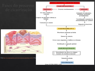 Fases do processo
de cicatrização
(Fonte:http://www.plasticaplexus.com.br/new/cicatrizacao.php#sthash.16C8Tx PF.dpbs)
 