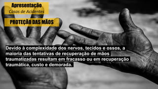 PROTEÇÃO DAS MÃOS
Devido à complexidade dos nervos, tecidos e ossos, a
maioria das tentativas de recuperação de mãos
traumatizadas resultam em fracasso ou em recuperação
traumática, custo e demorada.
Apresentação
Casos de Acidentes
 