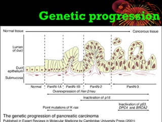 Genetic progression
 