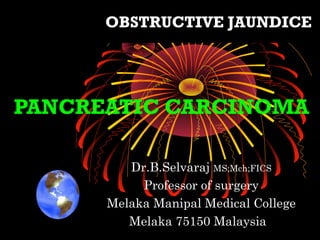PANCREATIC CARCINOMA
Dr.B.Selvaraj MS;Mch;FICS
Professor of surgery
Melaka Manipal Medical College
Melaka 75150 Malaysia
OBSTRUCTIVE JAUNDICE
 