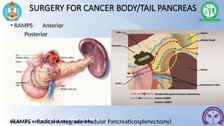Updated core concepts for management of Pancreatic cancer | PPTX