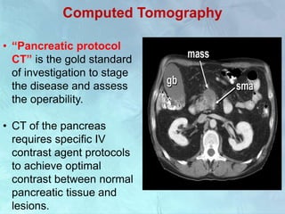 Computed Tomography
• “Pancreatic protocol
CT” is the gold standard
of investigation to stage
the disease and assess
the operability.
• CT of the pancreas
requires specific IV
contrast agent protocols
to achieve optimal
contrast between normal
pancreatic tissue and
lesions.
 