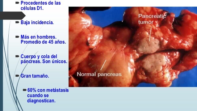GLUCAGONOMA PANCREATICO PDF DOWNLOAD GLUCAGONOMA PANCREATICO PDF DOWNLOAD
