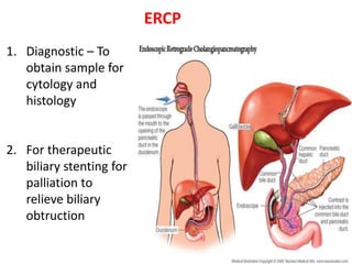 ERCP
1. Diagnostic – To
obtain sample for
cytology and
histology
2. For therapeutic
biliary stenting for
palliation to
relieve biliary
obtruction
 