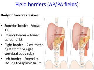 Field borders (AP/PA fields)
Body of Pancreas lesions
• Superior border - Above
T11
• Inferior border – Lower
border of L3
• Right border – 2 cm to the
right from the right
vertebral body edge
• Left border – Extend to
include the splenic hilum
 