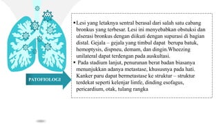 PATOFIOLOGI
Lesi yang letaknya sentral berasal dari salah satu cabang
bronkus yang terbesar. Lesi ini menyebabkan obstuksi dan
ulserasi bronkus dengan diikuti dengan supurasi di bagian
distal. Gejala – gejala yang timbul dapat berupa batuk,
hemoptysis, dispneu, demam, dan dingin.Wheezing
unilateral dapat terdengan pada auskultasi.
 Pada stadium lanjut, penurunan berat badan biasanya
menunjukkan adanya metastase, khususnya pada hati.
Kanker paru dapat bermetastase ke struktur – struktur
terdekat seperti kelenjar limfe, dinding esofagus,
pericardium, otak, tulang rangka
 