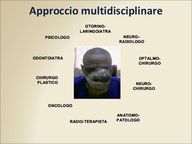 Quello che aiuterà a una grata varicosa