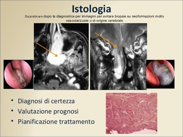Chirurgia vascolare renale