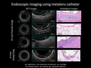 Endoscopic imaging using metalens catheter
Exvivohumanlungs
invivo
sheeplung
Histological imagesOCT images
epi: epithelium; bm: basement membrane; car: cartilage
ves: blood vessels; alv: alveolar; gp: glandular patterns
 