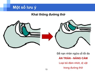 Cap cuu ban dau | PPT