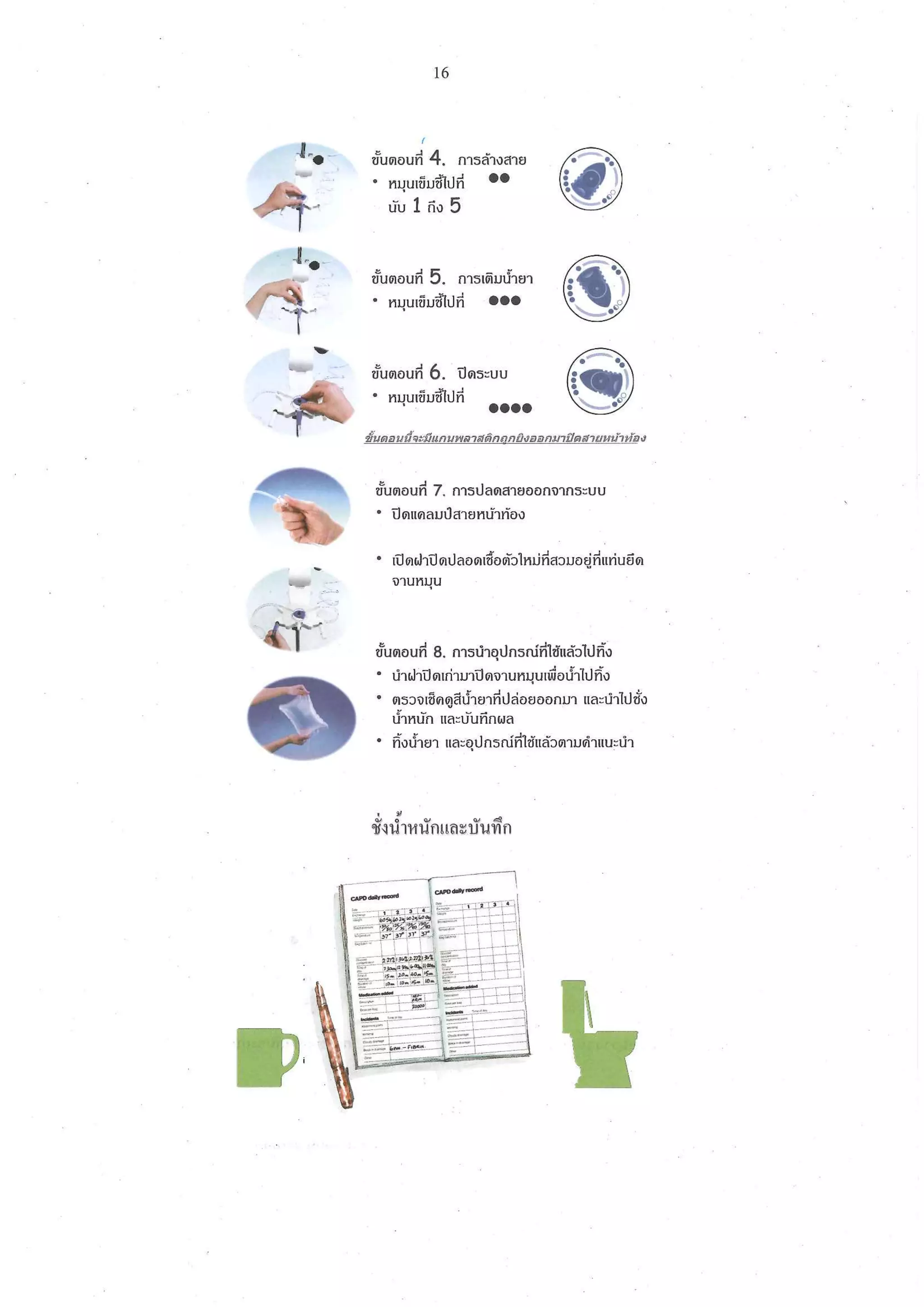 คู่มือการดูแลผู้ป่วยล้างไตทางช่องท้องแบบต่อเนื่อง (CAPD) ในชุมชน | PDF