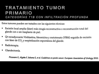 T R A T A M I E N T O T U M O R
P R I M A R I O
C A T E G O R Í A S T 1 B C O N I N F I L T R A C I Ó N P R O F U N D A
 