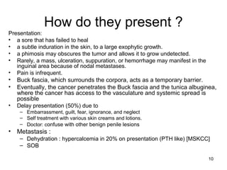 10
How do they present ?
Presentation:
• a sore that has failed to heal
• a subtle induration in the skin, to a large exophytic growth.
• a phimosis may obscures the tumor and allows it to grow undetected.
• Rarely, a mass, ulceration, suppuration, or hemorrhage may manifest in the
inguinal area because of nodal metastases.
• Pain is infrequent.
• Buck fascia, which surrounds the corpora, acts as a temporary barrier.
• Eventually, the cancer penetrates the Buck fascia and the tunica albuginea,
where the cancer has access to the vasculature and systemic spread is
possible
• Delay presentation (50%) due to
– Embarrassment, guilt, fear, ignorance, and neglect
– Self treatment with various skin creams and lotions.
– Doctor: confuse with other benign penile lesions
• Metastasis :
– Dehydration : hypercalcemia in 20% on presentation (PTH like) [MSKCC]
– SOB
 