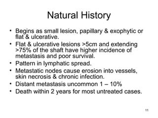 11
Natural History
• Begins as small lesion, papillary & exophytic or
flat & ulcerative.
• Flat & ulcerative lesions >5cm and extending
>75% of the shaft have higher incidence of
metastasis and poor survival.
• Pattern in lymphatic spread.
• Metastatic nodes cause erosion into vessels,
skin necrosis & chronic infection.
• Distant metastasis uncommon 1 – 10%
• Death within 2 years for most untreated cases.
 