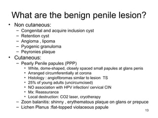 13
What are the benign penile lesion?
• Non cutaneous:
– Congenital and acquire inclusion cyst
– Retention cyst
– Angioma , lipoma
– Pyogenic granuloma
– Peyronies plaque
• Cutaneous:
– Pearly Penile papules (PPP)
• White, dome-shaped, closely spaced small papules at glans penis
• Arranged circumferentially at corona
• Histology : angiofibromas similar to lesion TS
• 25% of young adults (uncircumcised)
• NO association with HPV infection/ cervical CIN
• Mx: Reassurance
• Local destruction: CO2 laser, cryotherapy
– Zoon balanitis: shinny , erythematous plaque on glans or prepuce
– Lichen Planus :flat-topped violaceous papule
 