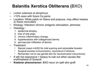 19
Balanitis Xerotica Obliterans (BXO)
– Lichen sclerosis et atrophicus
– >10% asso with future Ca penis
– Location: White patch on Glans and prepuce, may affect meatus
or fossa navicularis
– Etiology: Infection/ chronic antigenic stimulation, phimosis
– Histology :
1. epidermal atrophy,
2. loss of rete pegs,
3. chronic inflammatory change,
4. hyperkeratosis with collagenized dermis
5. perivascular infiltration of dermis
– Treatment:
• Steroid cream 4-6/52 for mild scarring and retractable foreskin
• Surgical excision (circumcision), reconstruct if stricture.
• Remember not to use genital skin for reconstruction (recurrence)
– If still not responsive > biopsy to rule out other causes like
erythroplasia of Queyrat
– Koebner phenomenon: BXO recur on split skin graft
 
