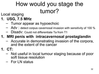 32
How would you stage the
tumor?Local staging
1. USG, 7.5 MHz
– Tumor appear as hypoechoic
– Adv : detect corpus cavernosal invasion with sensitivity of 100 %
– Disadv: Could not differentiate Ta from T1
1. MRI penis with intracavernosal prostaglandin
– Accurate in demonstrating invasion of the corpora,
and the extent of the cancer
1. CT:
– Not useful in local tumour staging because of poor
soft tissue resolution
– For LN status
 
