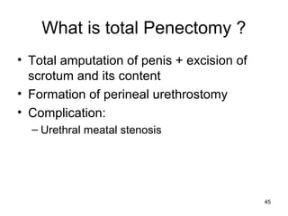 45
What is total Penectomy ?
• Total amputation of penis + excision of
scrotum and its content
• Formation of perineal urethrostomy
• Complication:
– Urethral meatal stenosis
 