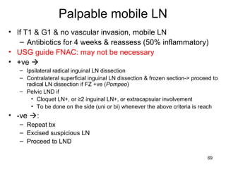 69
Palpable mobile LN
• If T1 & G1 & no vascular invasion, mobile LN
– Antibiotics for 4 weeks & reassess (50% inflammatory)
• USG guide FNAC: may not be necessary
• +ve 
– Ipsilateral radical inguinal LN dissection
– Contralateral superficial inguinal LN dissection & frozen section-> proceed to
radical LN dissection if FZ +ve (Pompeo)
– Pelvic LND if
• Cloquet LN+, or ≥2 inguinal LN+, or extracapsular involvement
• To be done on the side (uni or bi) whenever the above criteria is reach
• -ve :
– Repeat bx
– Excised suspicious LN
– Proceed to LND
 