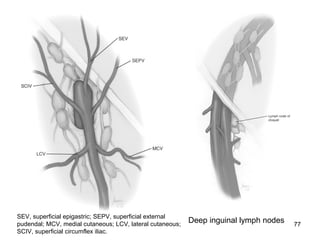 77
SEV, superficial epigastric; SEPV, superficial external
pudendal; MCV, medial cutaneous; LCV, lateral cutaneous;
SCIV, superficial circumflex iliac.
Deep inguinal lymph nodes
 