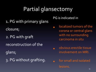 Partial glansectomy
1. PG with primary glans
closure;
2. PG with graft
reconstruction of the
glans;
3. PG without grafting.
PG is indicated in
• localized tumors of the
corona or central glans
with no surrounding
carcinoma in situ
• obvious erectile tissue
involvement on MRI.
• for small and isolated
lesions. 13
 