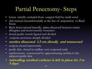 20
Partial Penectomy- Steps
• lesion initially excluded from surgical field by small towel
• skin incised circumferentially at the line of amputation to Buck
fascia
• Buck fascia incised laterally, plane dissected between tunica
albuginea and neurovascular structures
• dorsal penile vessels ligated and divided
• corpora cavernosa sharply divided
• urethra dissected 1.5 cm distally and transected
• corpora closed transversely
• penile skin closed in midline over corporeal ends
• urethrostomy constructed by approximating urethra to the
adjacent penile skin
• indwelling urethral catheter is left in place for 3 to
5 days
 